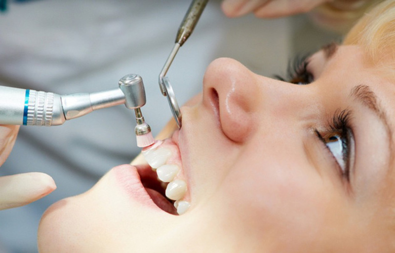 Sử dụng máy siêu âm để lấy vôi răng 