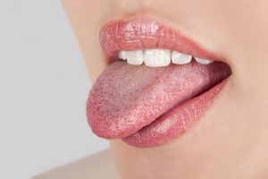 Tưa Miệng Là Gì? Những Thông Tin Quan Trọng Về Tưa Miệng