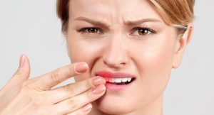 Viêm nha chu có lây không? Cách chữa dứt điểm viêm nha chu