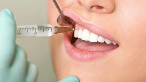 Viêm tủy răng uống thuốc gì để giảm đau và điều trị triệt để