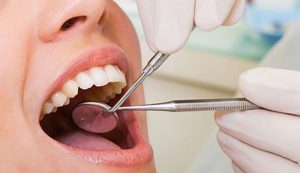 Bà bầu bị viêm tủy răng, mức độ nguy hiểm và cách chữa trị