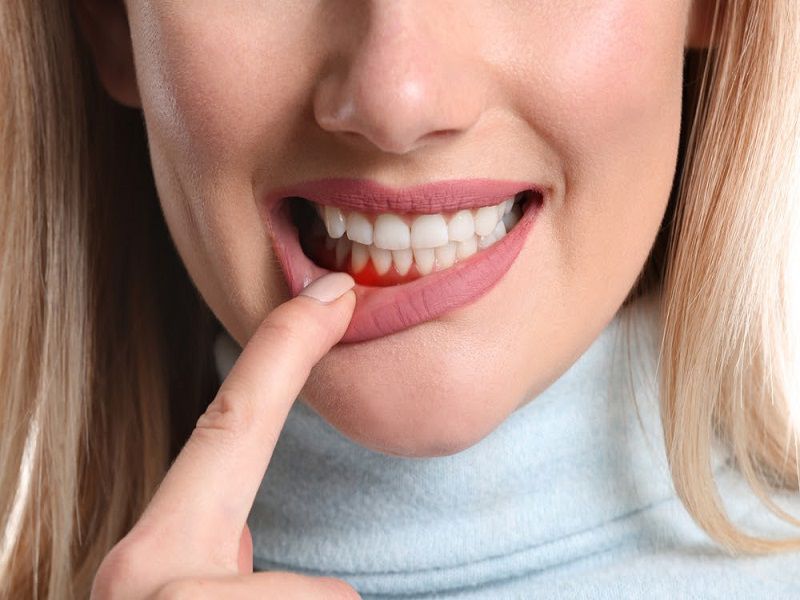 Bên cạnh việc áp dụng thuốc nam chữa viêm nha chu bạn cũng cần quan tâm đến việc chăm sóc răng miệng