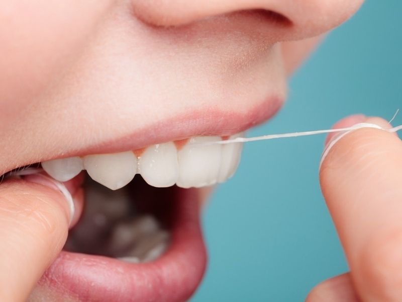 Sử dụng chỉ nha khoa để nâng cao tuổi thọ răng sau khi dán sứ