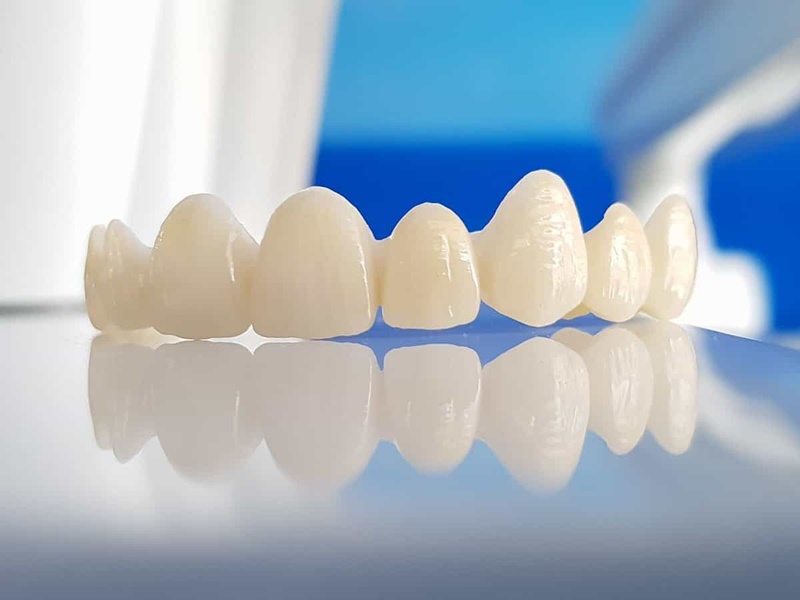 Loại răng sứ cũng là yếu tố quyết định giá trồng răng cao hay thấp