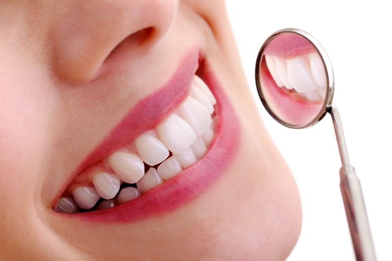 Trồng răng sứ giá bao nhiêu một chiếc phụ thuộc vào phương pháp trồng răng