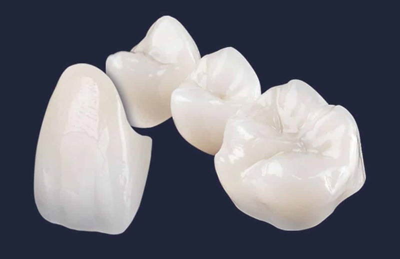 Răng sứ Zirconia có khả năng chịu lực khoảng 400 Mpa