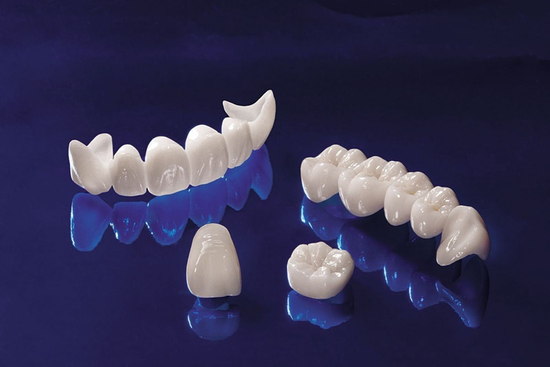 Răng sứ loại nào tốt nhất có thể kể đến răng sứ Nacera