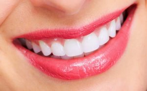 Giải đáp trồng răng sứ loại nào tốt nhất hiện nay
