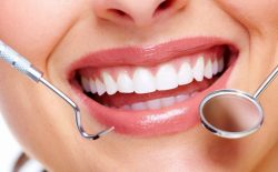 Trồng răng sứ mất bao lâu và cách chăm sóc để răng được bền đẹp