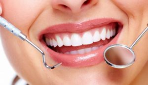 Trồng răng sứ mất bao lâu và cách chăm sóc để răng được bền đẹp