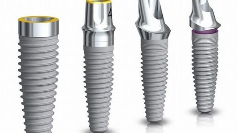 Hiện nay có bốn loại trụ implant được dùng phổ biến